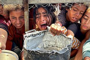 Moaz Abu Taha/APA Images via ZUMA Press Wire/dpa | Unicef warnt vor den fatalen Folgen der zunehmenden Mangelernährung von Kindern im Gazastreifen. Die Jüngsten gerieten durch Hunger und Krankheiten in einen Teufelskreis.